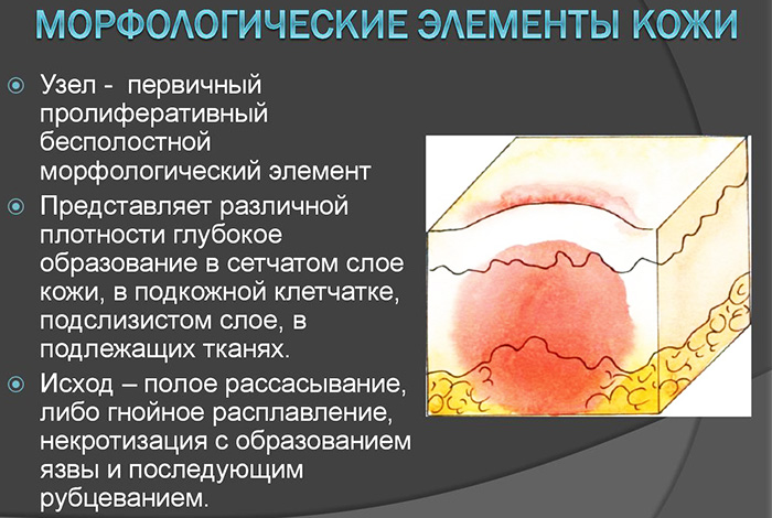 Морфологические элементы кожи первичные и вторичные. Таблица