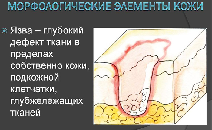 Морфологические элементы кожи первичные и вторичные. Таблица