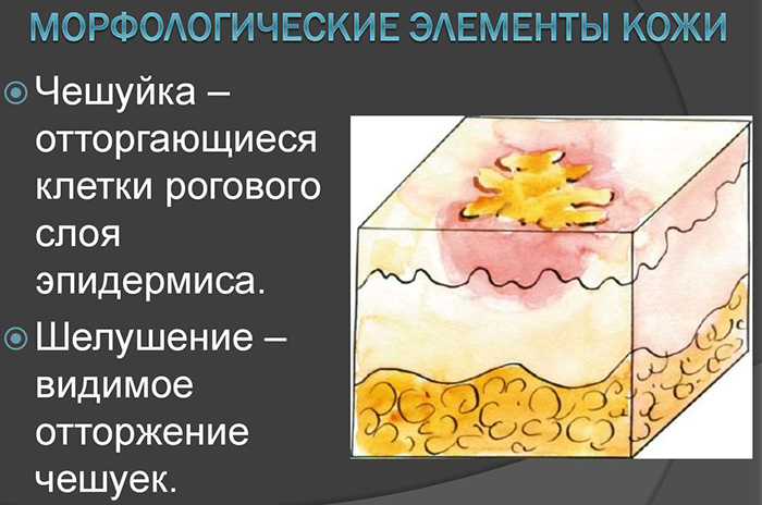 Морфологические элементы кожи первичные и вторичные. Таблица