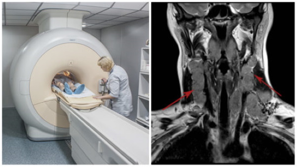 МРТ горла и гортани, глотки, пищевода. Что показывает, цена