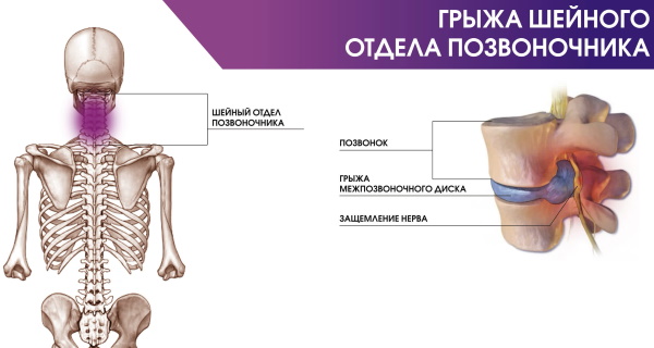 МРТ горла и гортани, глотки, пищевода. Что показывает, цена