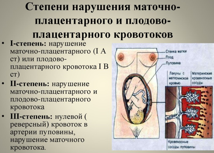 Нарушение МПК 1а/б степени при беременности. Что это такое