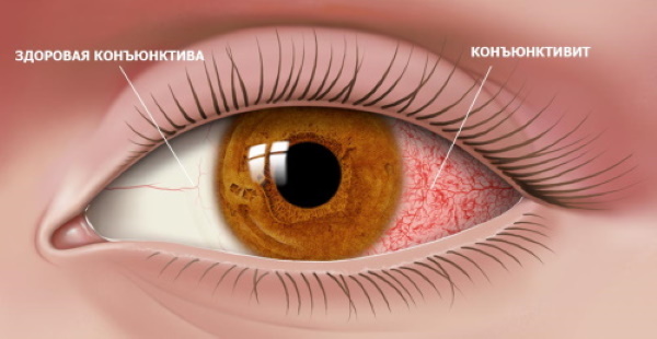 Окуметил глазные капли. Инструкция по применению, цена, отзывы