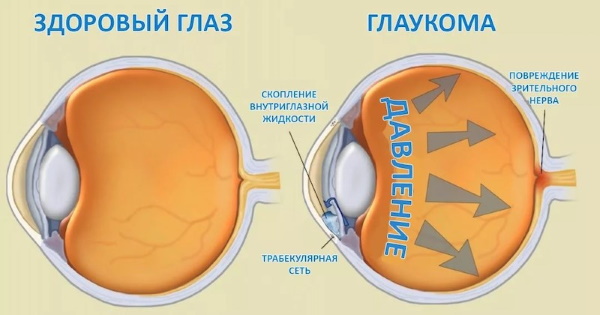 Окуметил глазные капли. Инструкция по применению, цена, отзывы