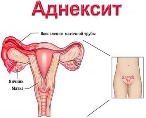 Парауретральные железы у женщин, мужчин. Что это такое, где находятся, функции