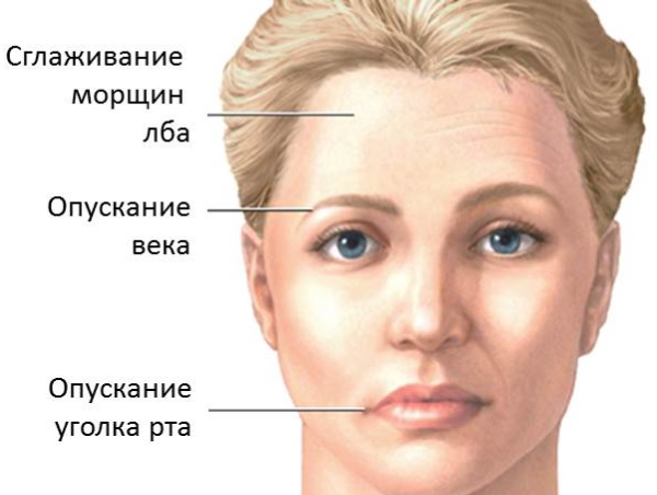 Передняя лестничная мышца шеи. Фото, функции, анатомия