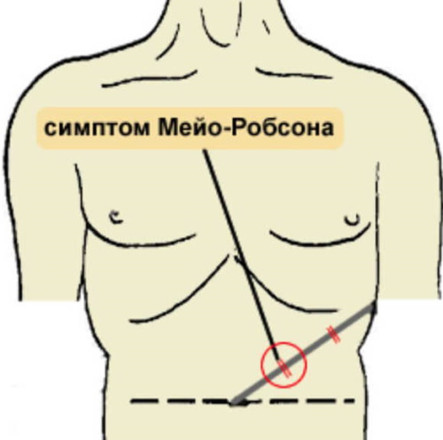 Симптомы панкреатита по авторам. Хирургия