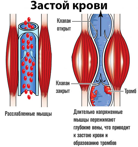 Венозная кровь. Где течет, норма цвет, глюкоза, сахар, почему темная, застой