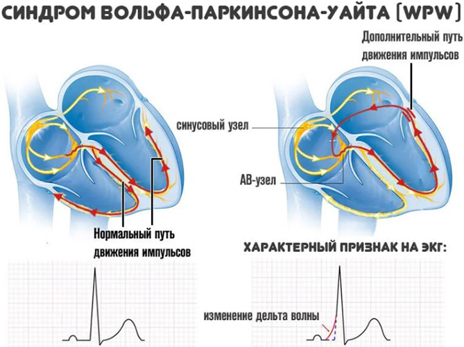 Верхняя полая вена. Анатомия, топография, как образуется, схема, притоки, схема