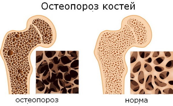 Висеть на турнике. Польза и вред для позвоночника, похудения, роста