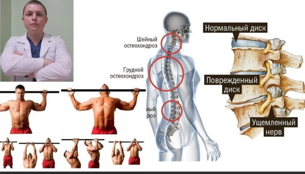 Висеть на турнике. Польза и вред для позвоночника, похудения, роста