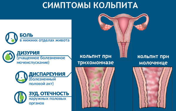 Жидкостная онкоцитология шейки матки. Что это такое, подготовка к процедуре, как делают