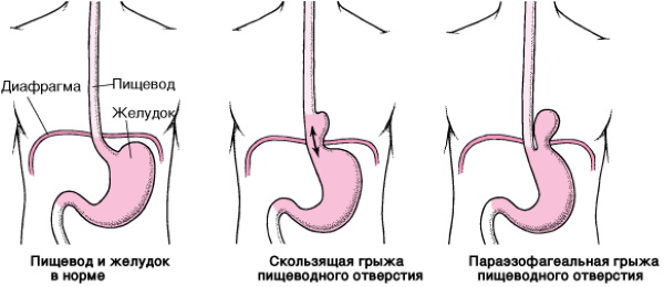 Диафрагма в теле человека. Что это в анатомии, фото-рентген, где находится, функции