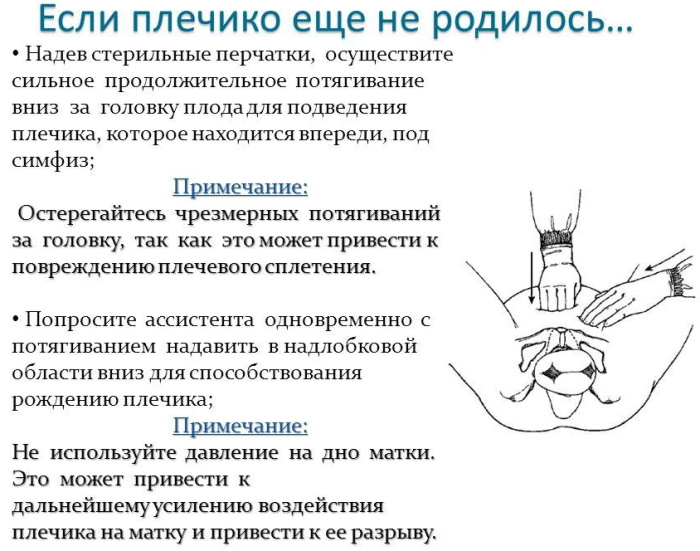 Дистоция плечиков в родах. Что это такое, причины, последствия для ребенка