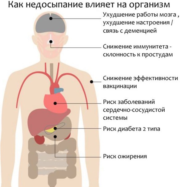 Недосыпание и его последствия для взрослого, ребенка