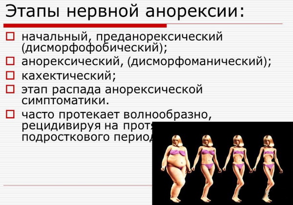 Нервная анорексия. Симптомы, признаки, лечение