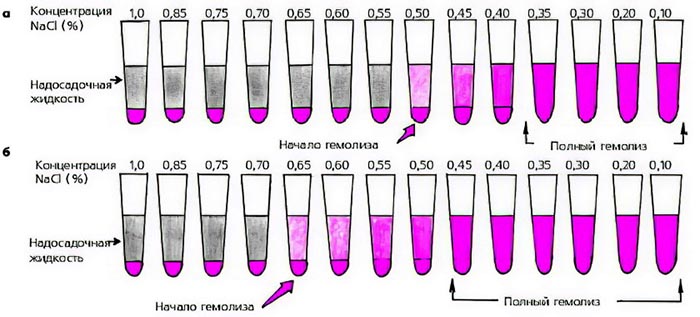 Осмотическая резистентность эритроцитов. Что это такое, как определяется, метод