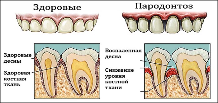 Осмотр полости рта и зева у детей, взрослых. Алгоритм манипуляции