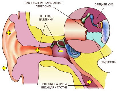 Овальное окно в ухе. Что это такое, функции, где находится