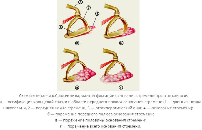 Овальное окно в ухе. Что это такое, функции, где находится