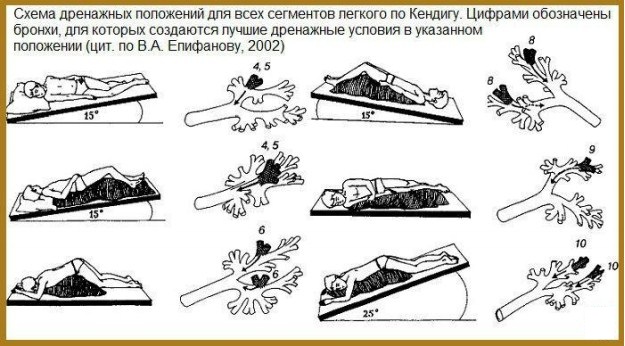 Постуральный дренаж для детей до года, 3-4-6-8 лет. Алгоритм