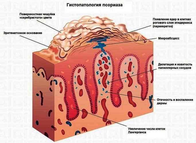 Прыщики на запястье чешутся: мелкие, водянистые, красные. Почему появились, фото