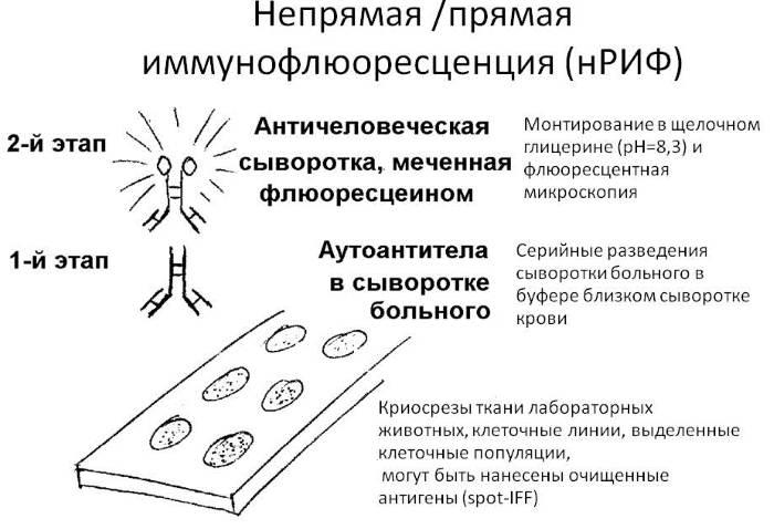 Ревмофактор (ревматоидный фактор) анализ крови. Что это такое, что показывает, норма