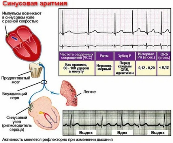 Синусовый ритм. Норма у женщин по возрасту на ЭКГ