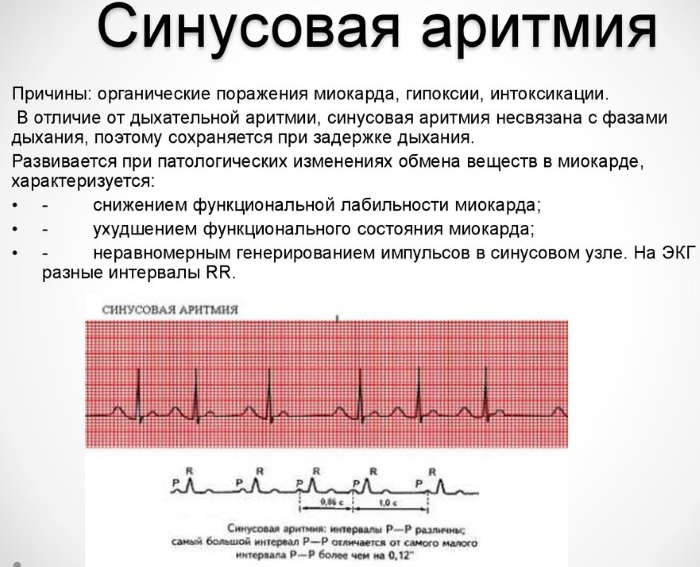 Синусовый ритм. Норма у женщин по возрасту на ЭКГ