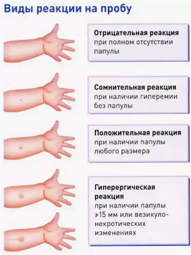 Температура 37 держится неделю у взрослого. Причины