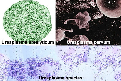 Уреаплазма у женщин фото выделений