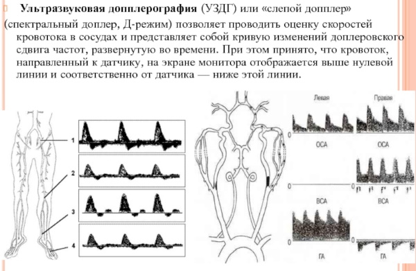 Уздг сосудов головы и шеи фото