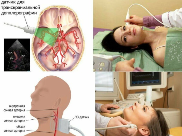 УЗДГ (допплерография) сосудов головы и шеи. Что это такое, как проводится, подготовка, цена