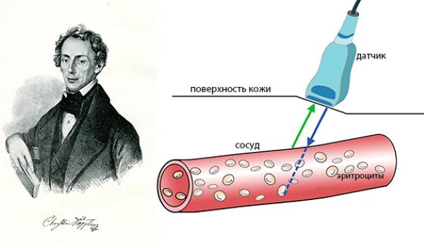 Уздг сосудов головы и шеи фото