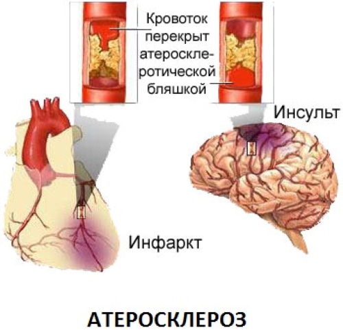 УЗДГ (допплерография) сосудов головы и шеи. Что это такое, как проводится, подготовка, цена