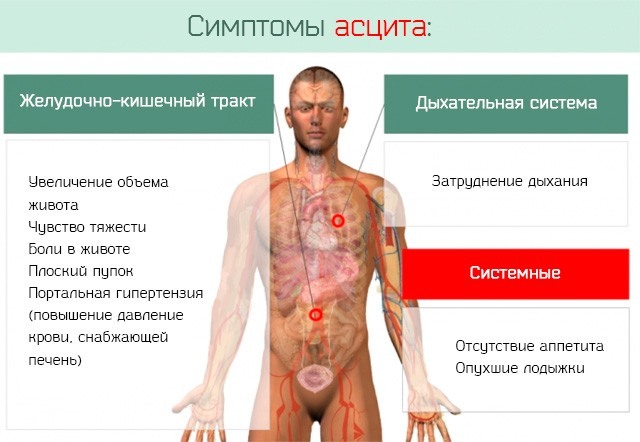 Фиброз печени. Симптомы, признаки, лечение