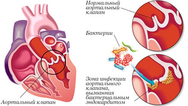 Сердце у человека. Где находится, расположено, фото