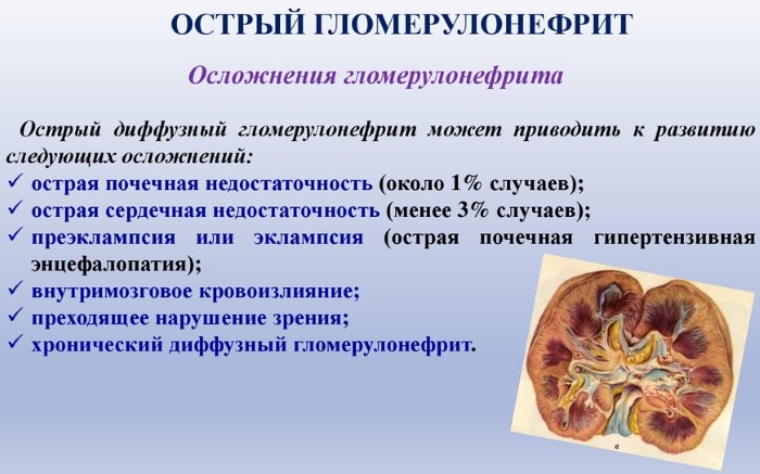 Гломерулонефрит у детей, взрослых. Диагностика, тактика лечения