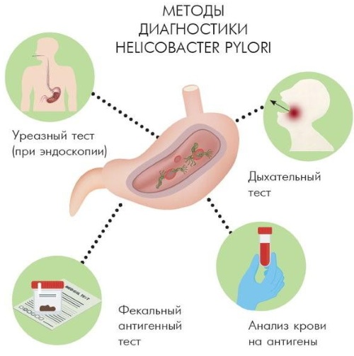 Бактерия хеликобактер пилори в желудке. Как лечить медикаментозно