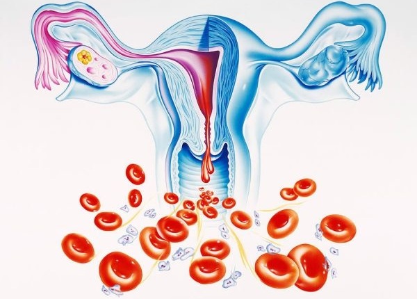 Маточное кровотечение при климаксе. Как остановить, причины
