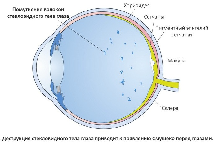 Мурашки в глазах. Причины и лечение