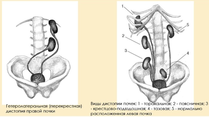 Где почки у женщин фото