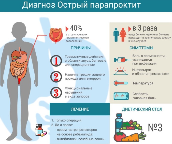 Парапроктит. Классификация по локализации, клиника, лечение