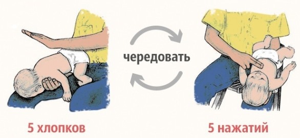 Прием Геймлиха у детей до 1 года и старше