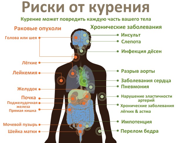 Профилактика гипертонической болезни