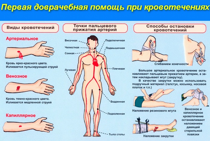 Суицид: причины, способы, последствия. Как избавиться от мыслей, первая помощь