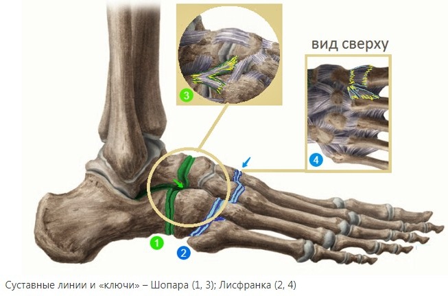 Сустав Шопара и Лисфранка. Анатомия, рентген, связки, вывих стопы, остеоартроз