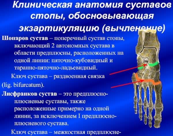 Сустав Шопара и Лисфранка. Анатомия, рентген, связки, вывих стопы, остеоартроз