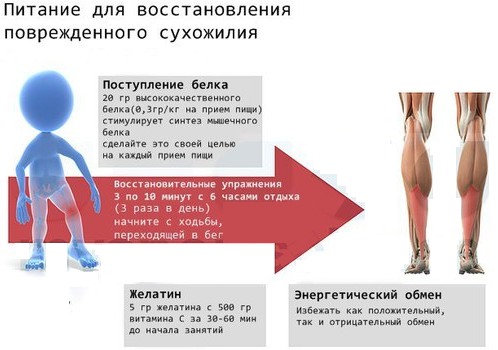 Связки и сухожилия. Укрепление витаминами, тренировка, препараты, гимнастика