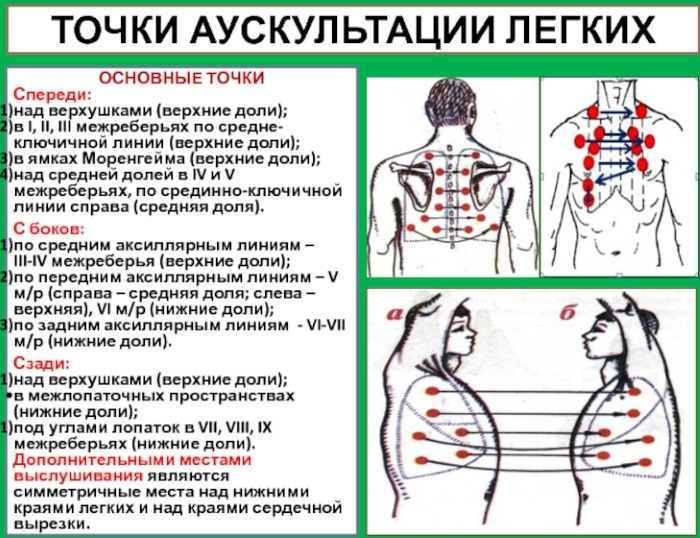 Воспаление бронхов. Симптомы у взрослых без и с температурой, лечение